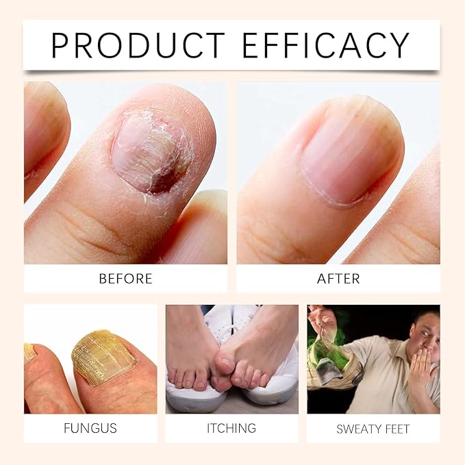 Spray reparador de uñas con veneno de abeja - additional image 2