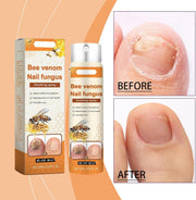 Spray reparador de uñas con veneno de abeja